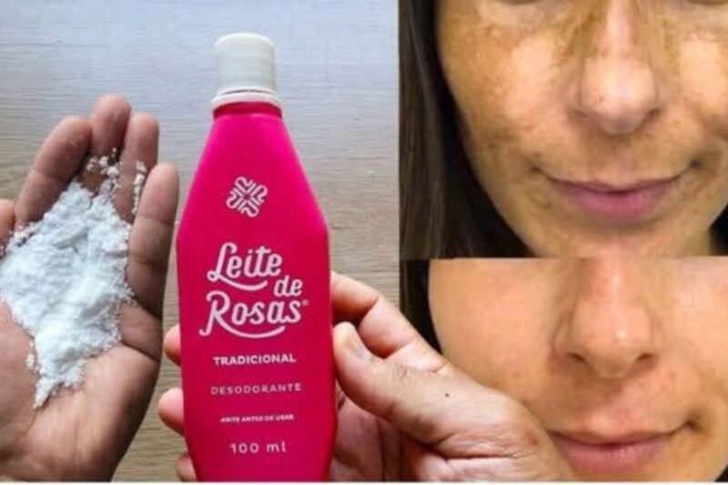 Como acabar com manchas e rugas em poucos dias
